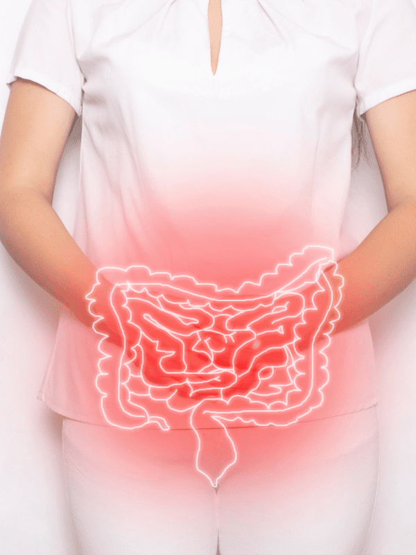 colitis en veracruz