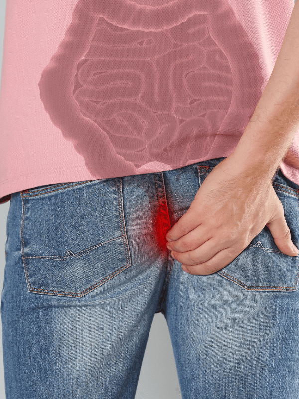 fistulas y abscesos anales en veracruz