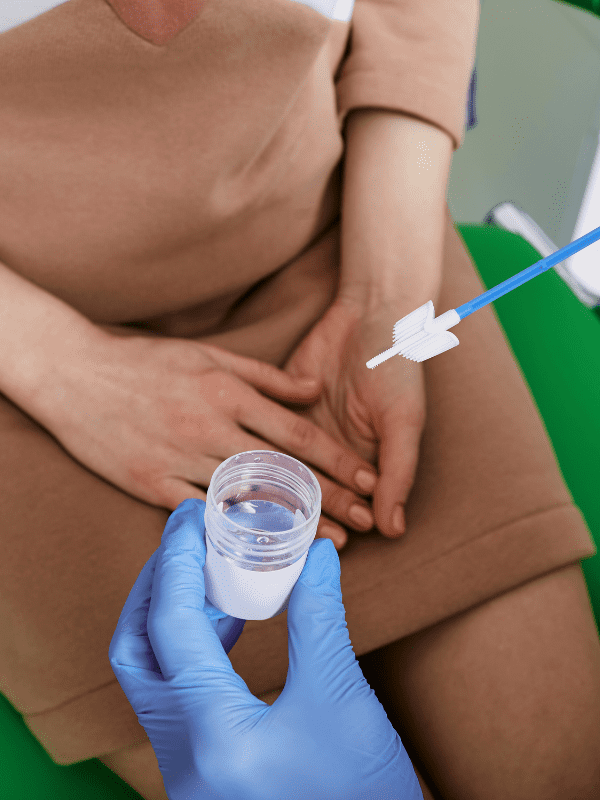 vph perianal en veracruz