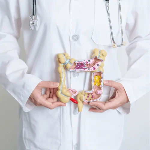 ¿Qué médico trata la diverticulitis?